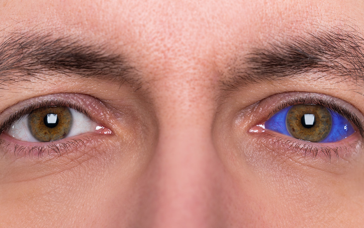 Extreme closeup of blue human eyeball showing the macula - Your Health